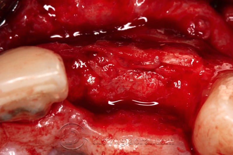 Occlusal view