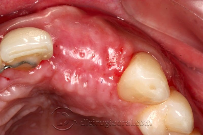 Occlusal view