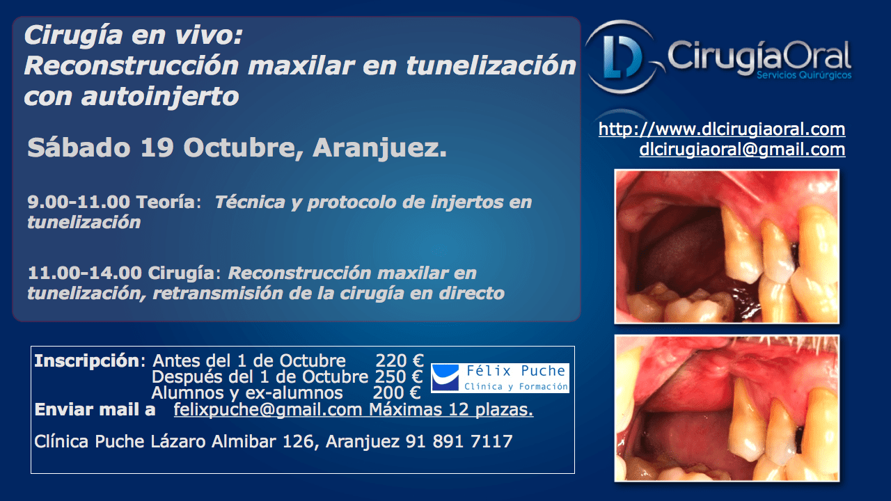 Course in maxillary reconstruction