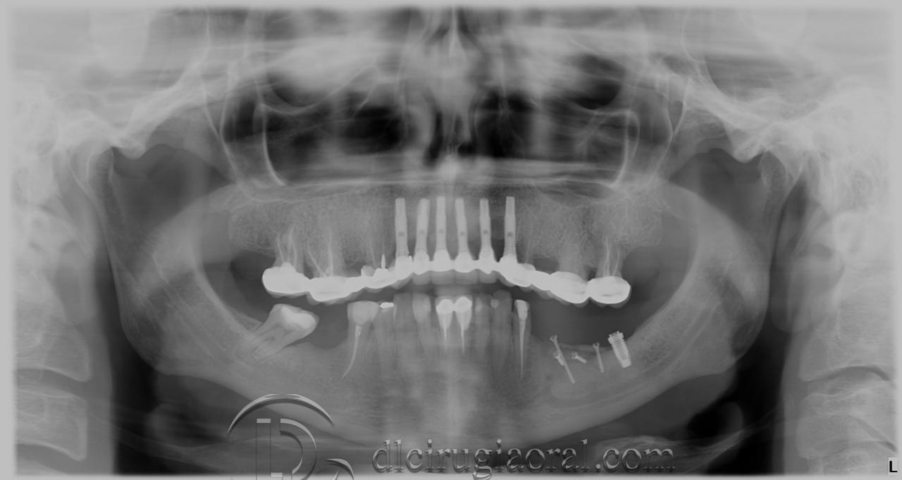 Control x-ray