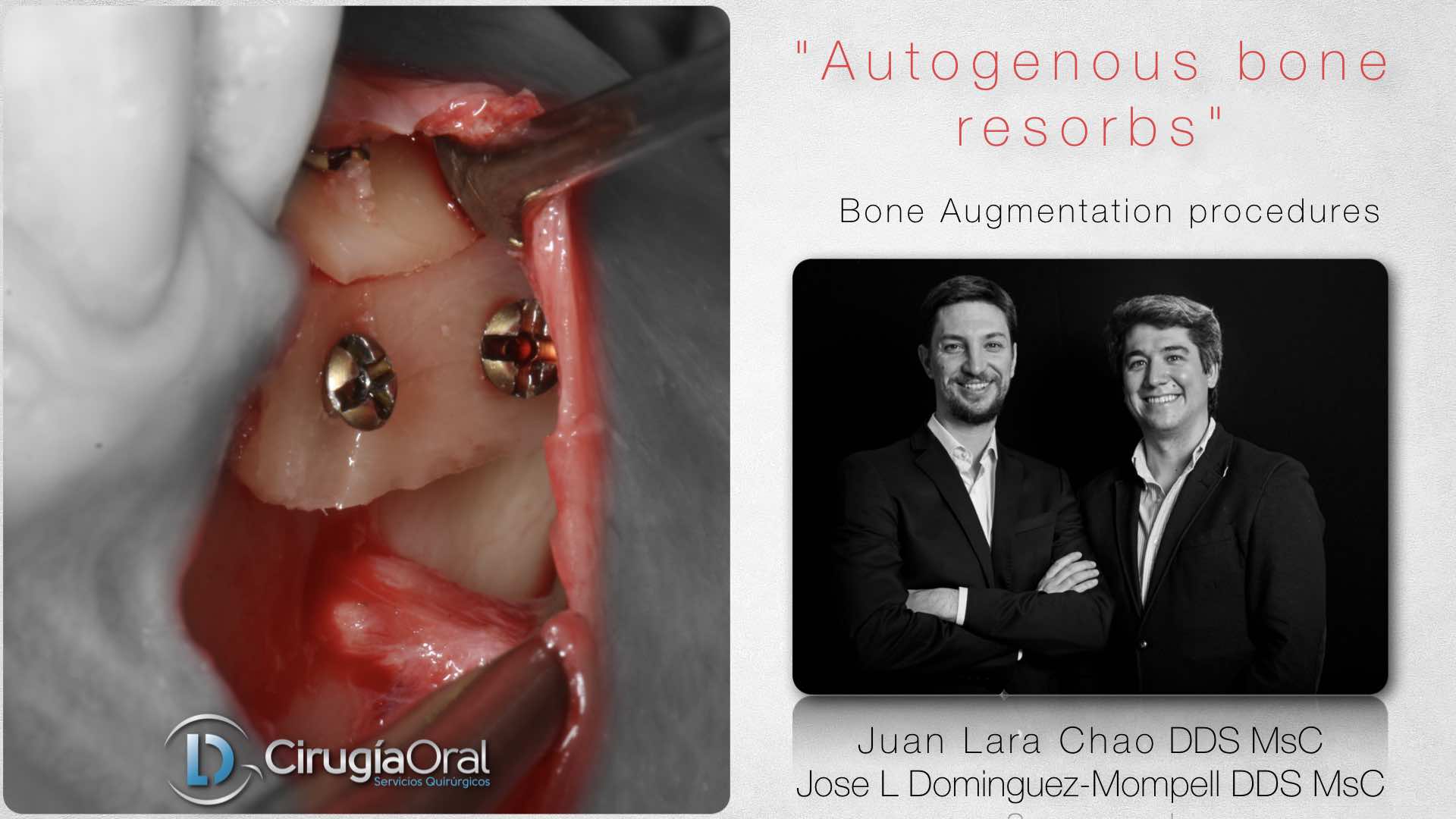 Free bone grafting webinar – Available now!