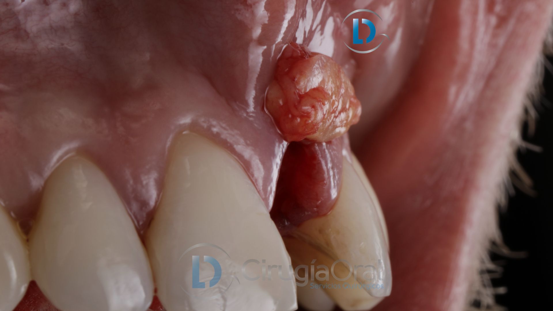 Dental implant in the aesthetic zone